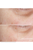 Lifting Cellular Dual Eye Solution