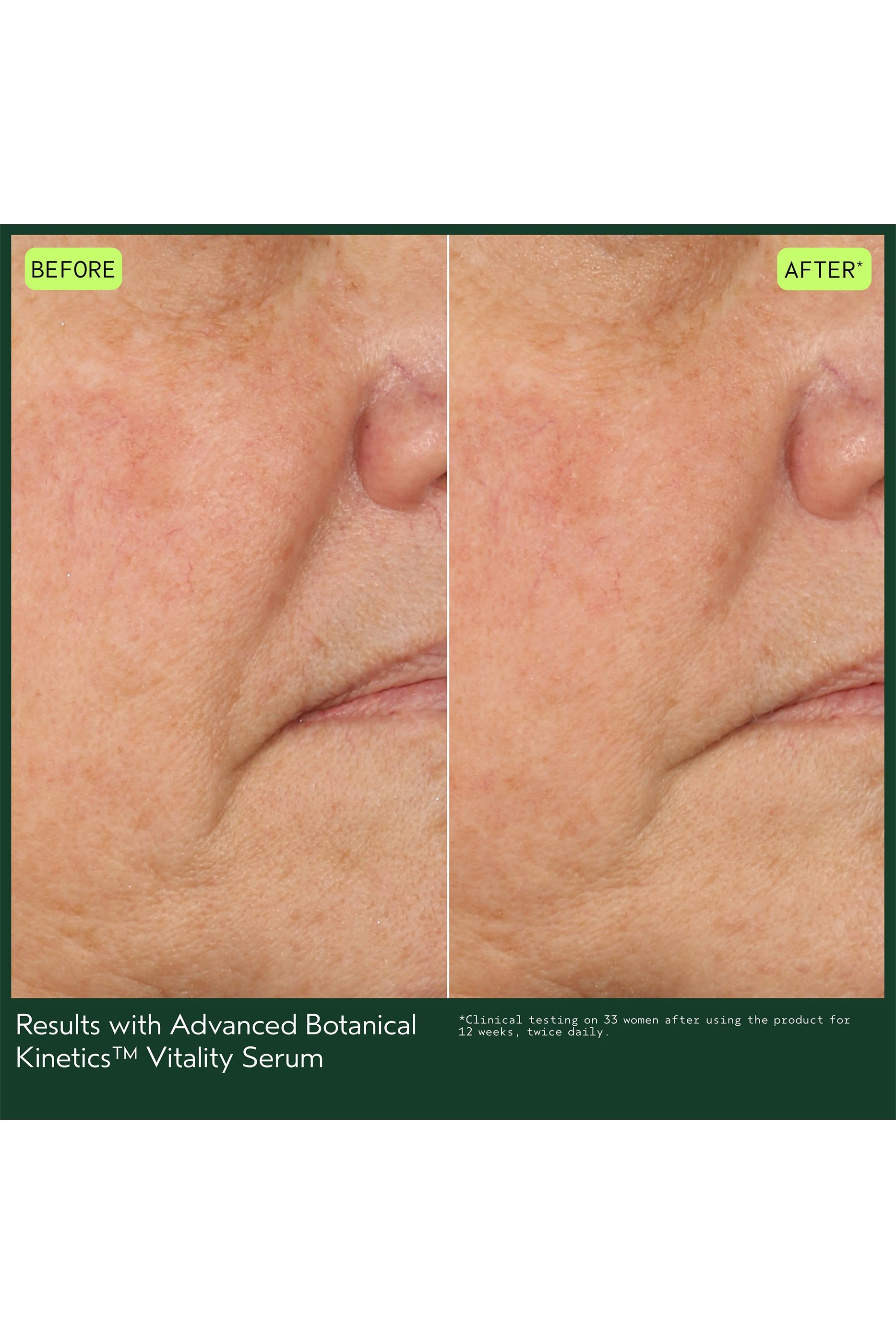 Advanced Botanical Kinetics&trade; Vitality Serum 