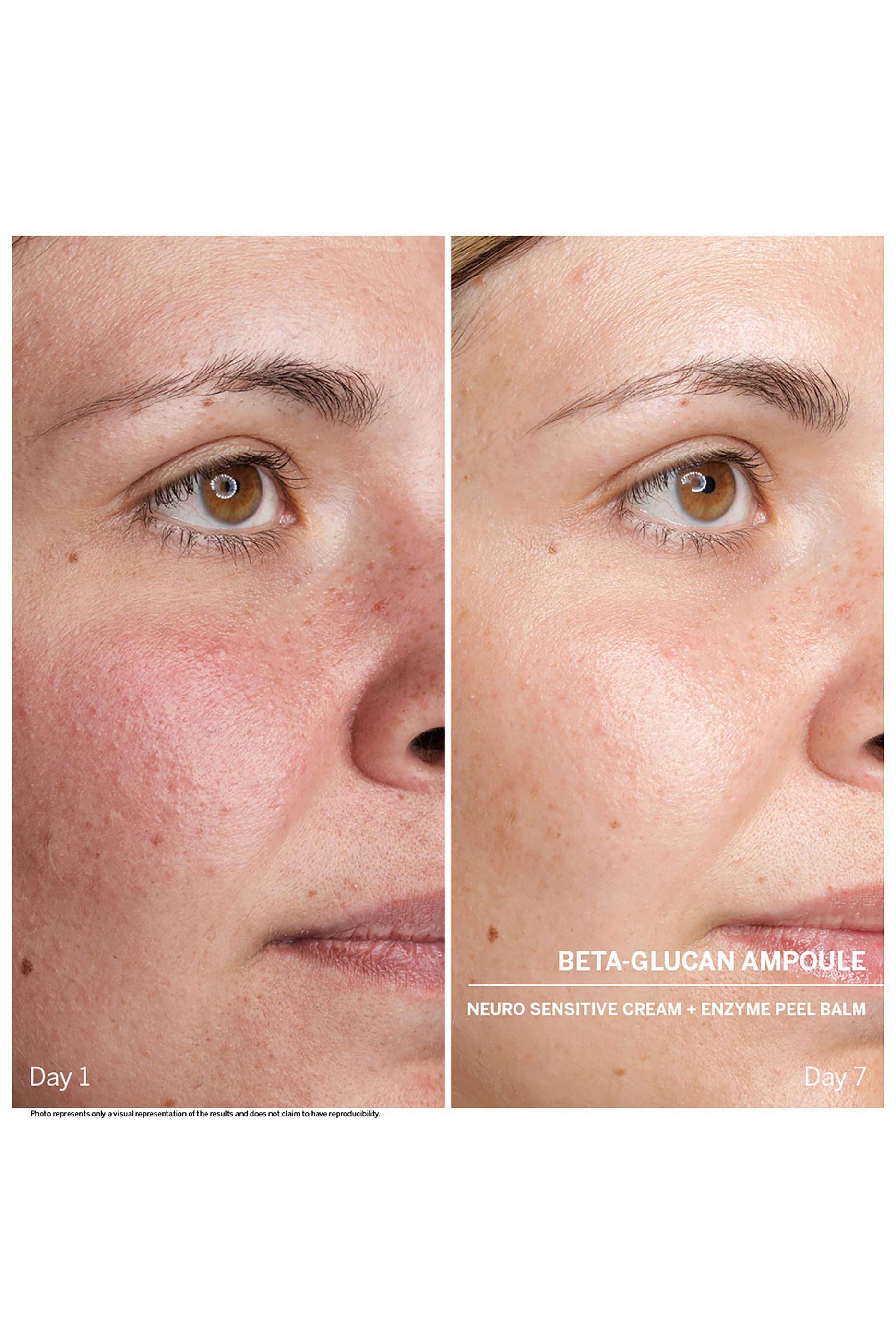 Beta-Glucan Power Serum Ampoules, Set Of 7