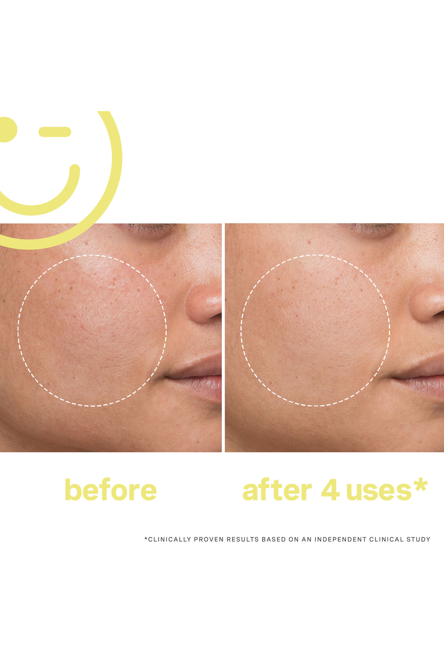 MEGA-C™ 30% Vitamin C Brightening Facial