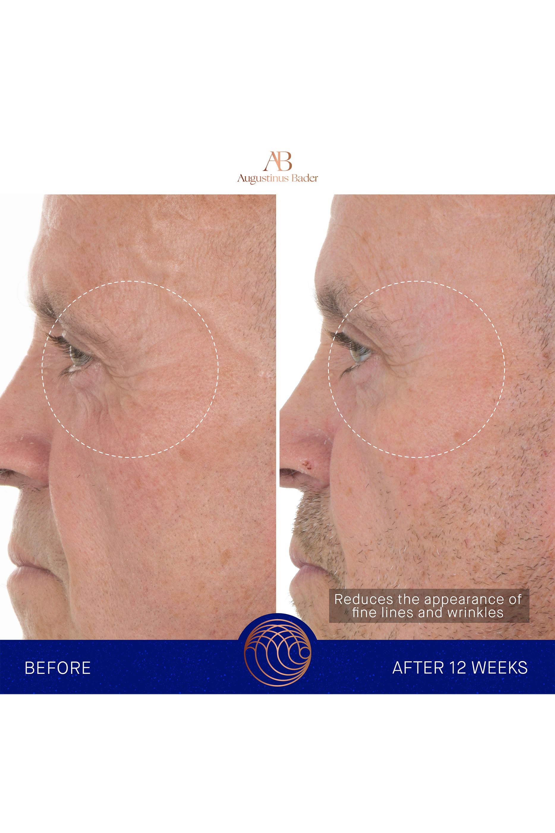 The Retinol Serum