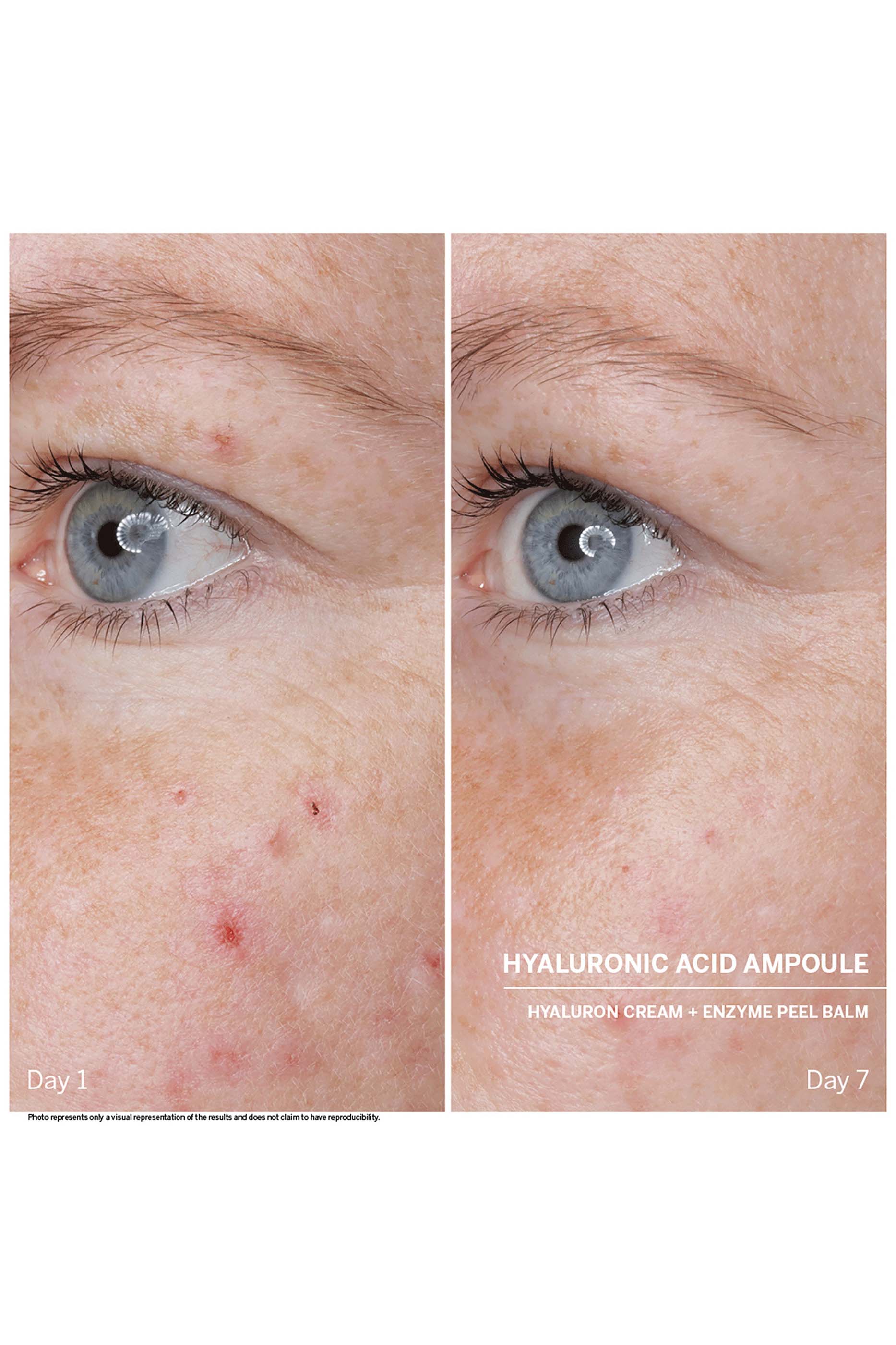 Hyaluronic Acid Power Serum Ampoules, Set Of 7