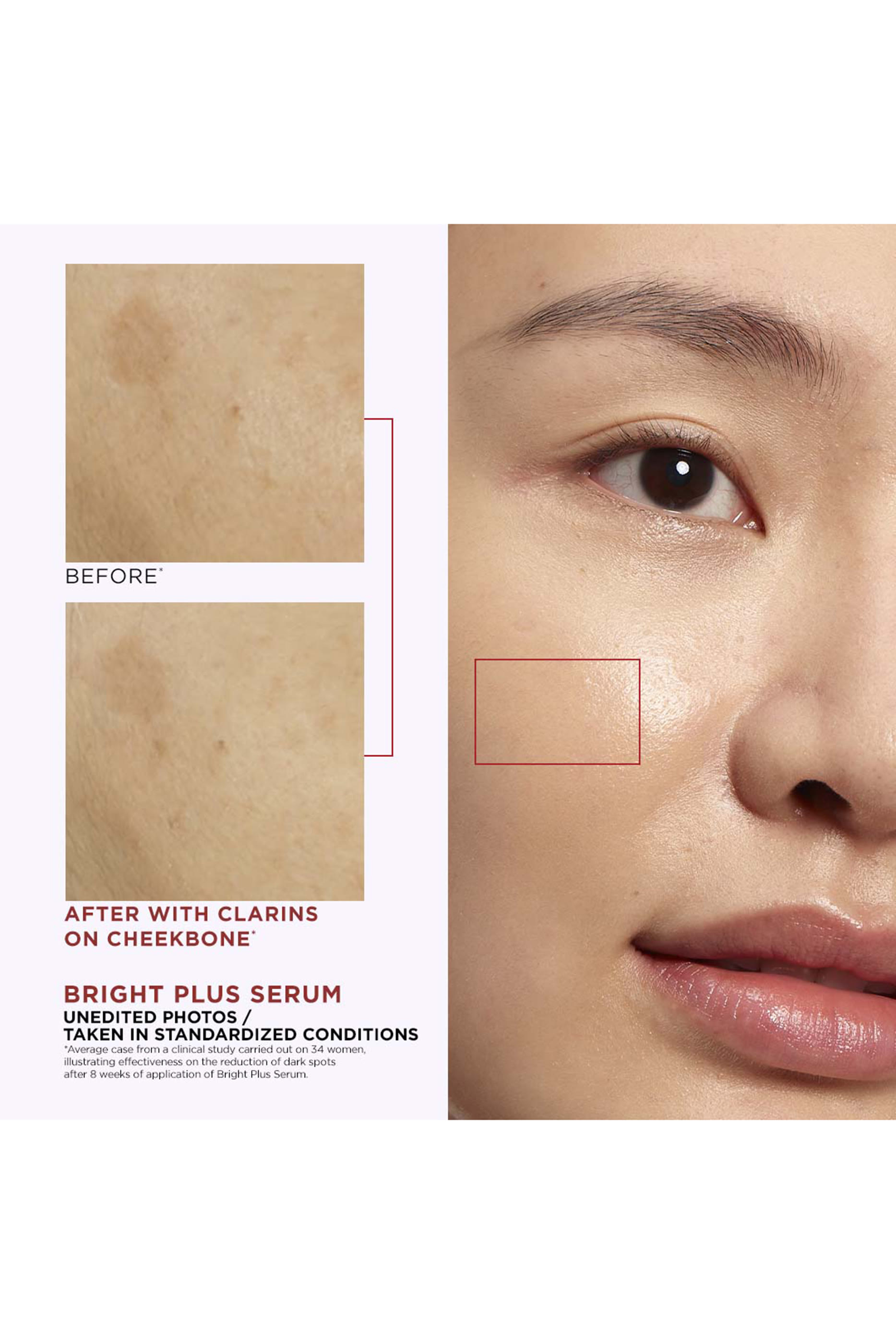 Bright Plus Dark Spot-Targeting Treatment Essence