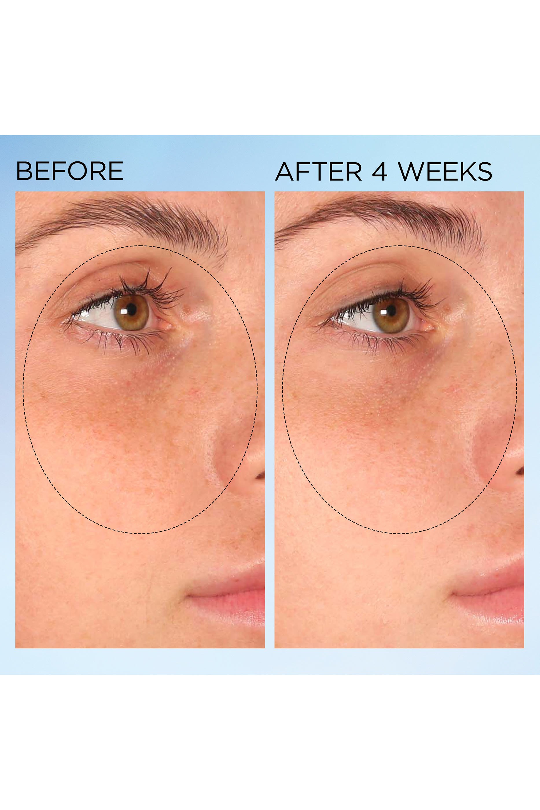  Visible Brightening Clearly Radiant Spot Correcting 60 Capsules