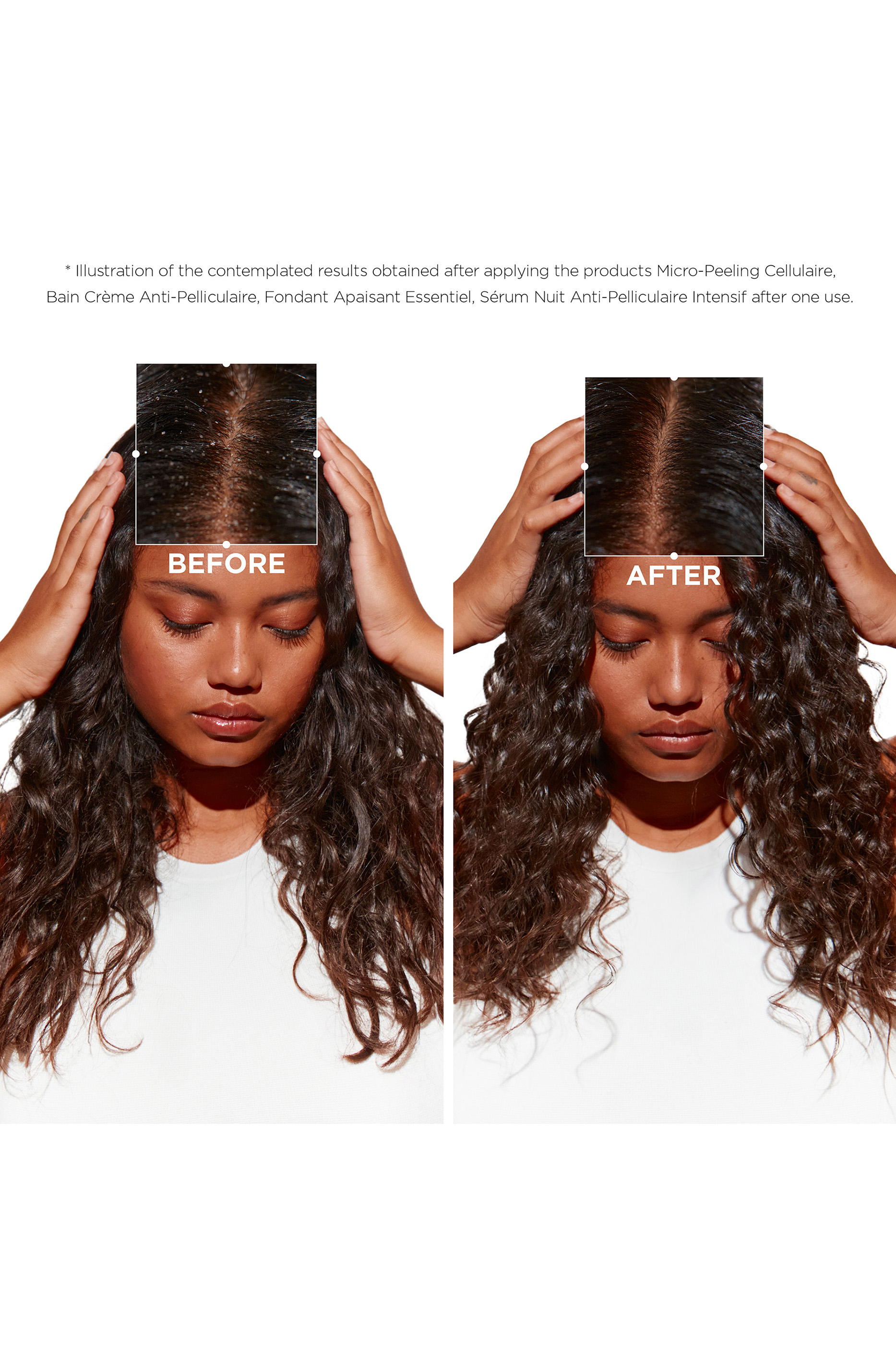 Symbiose Moisturising Anti-Dandruff Shampoo