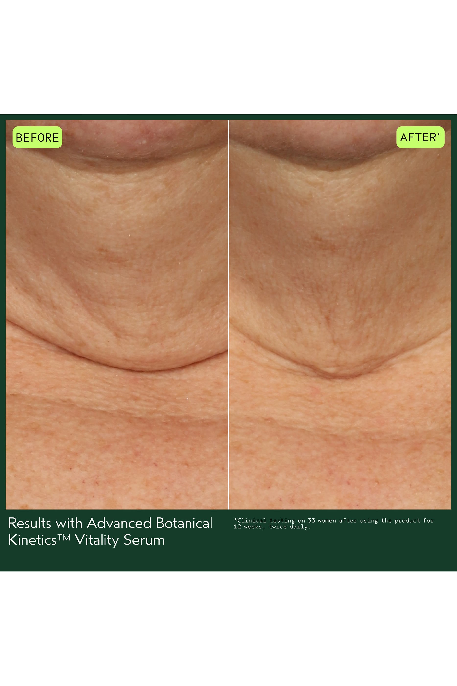 Advanced Botanical Kinetics&trade; Vitality Serum 