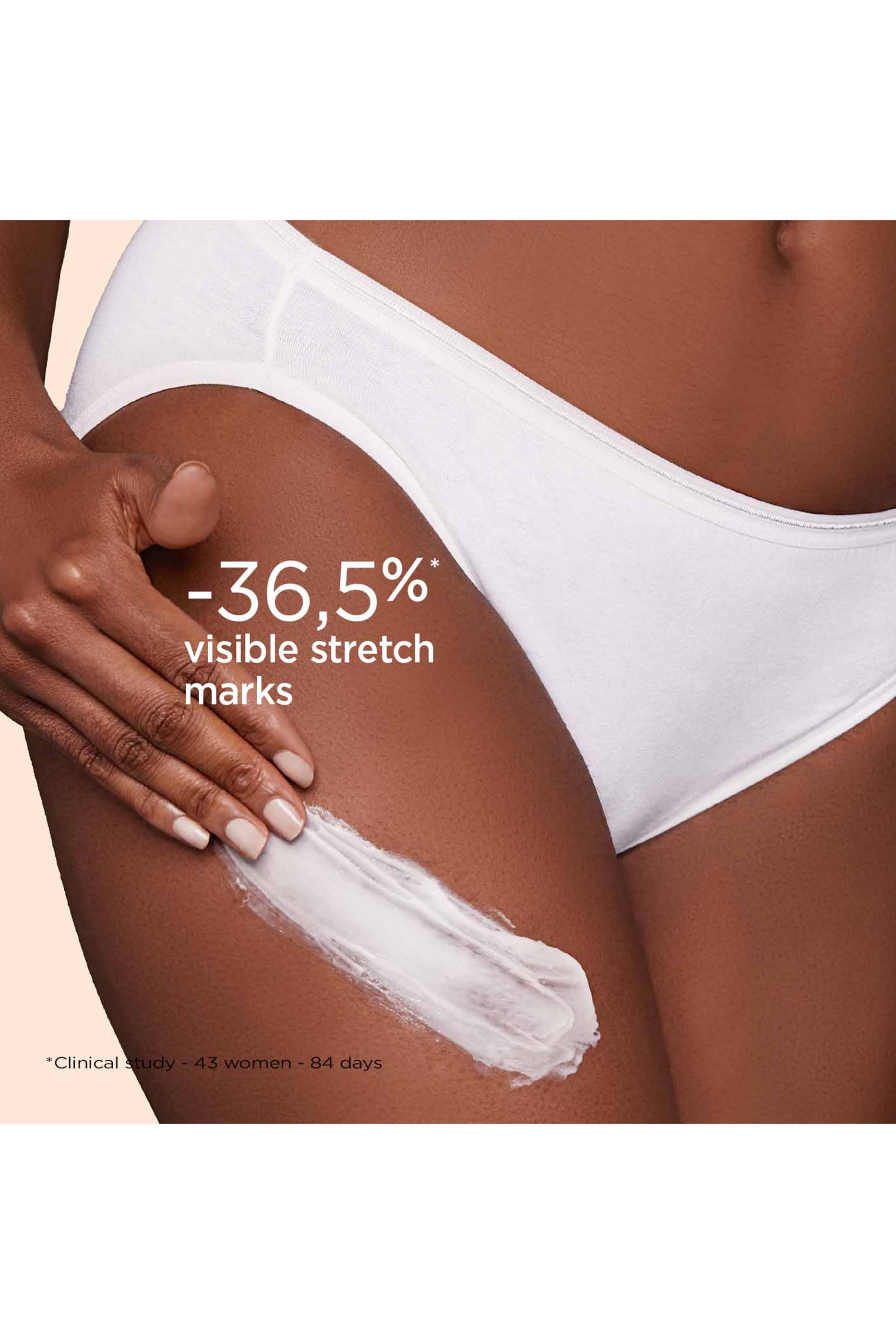 Body Partner Stretch Mark Expert