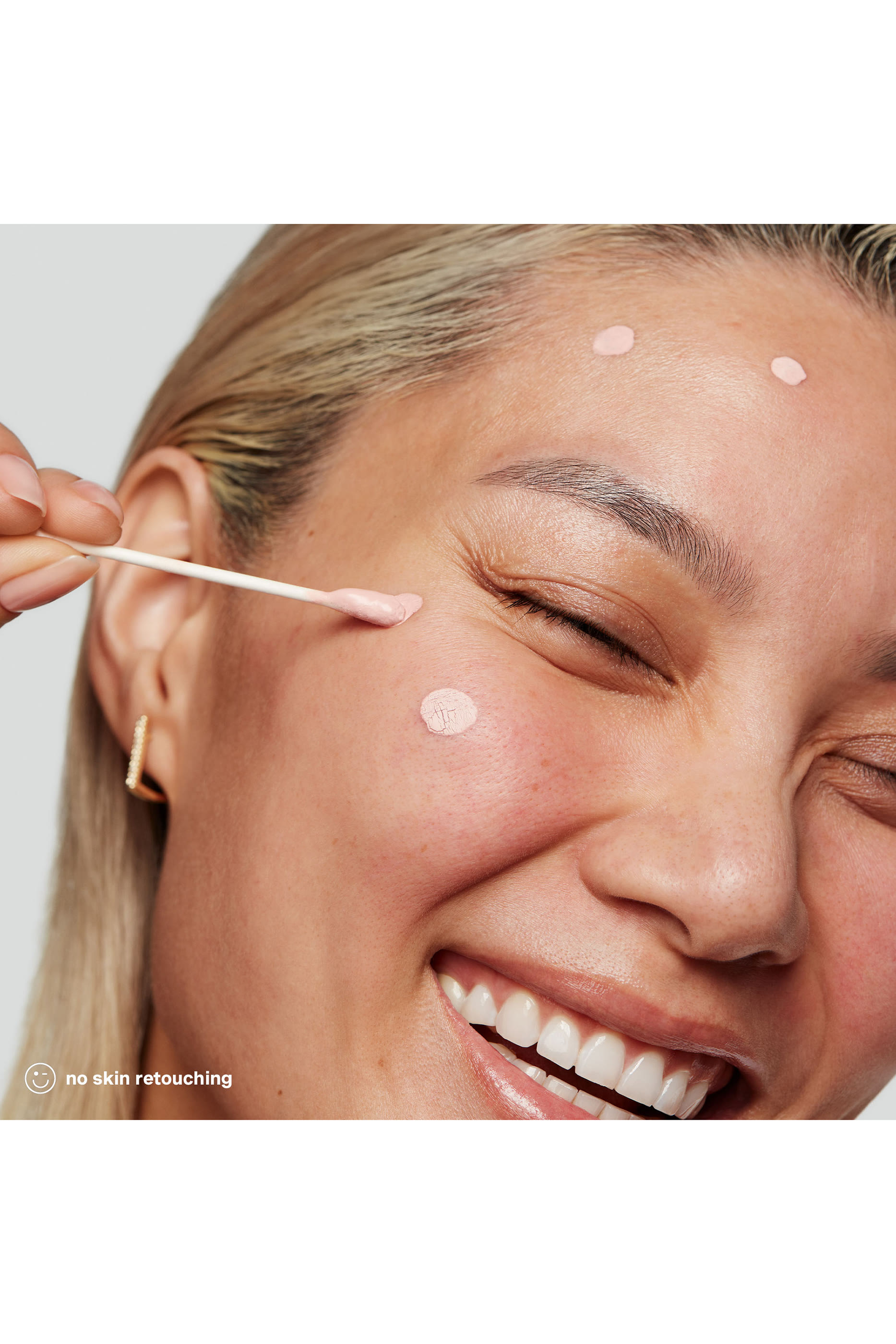 EradiKate&reg; 10% Sulfur Acne Treatment