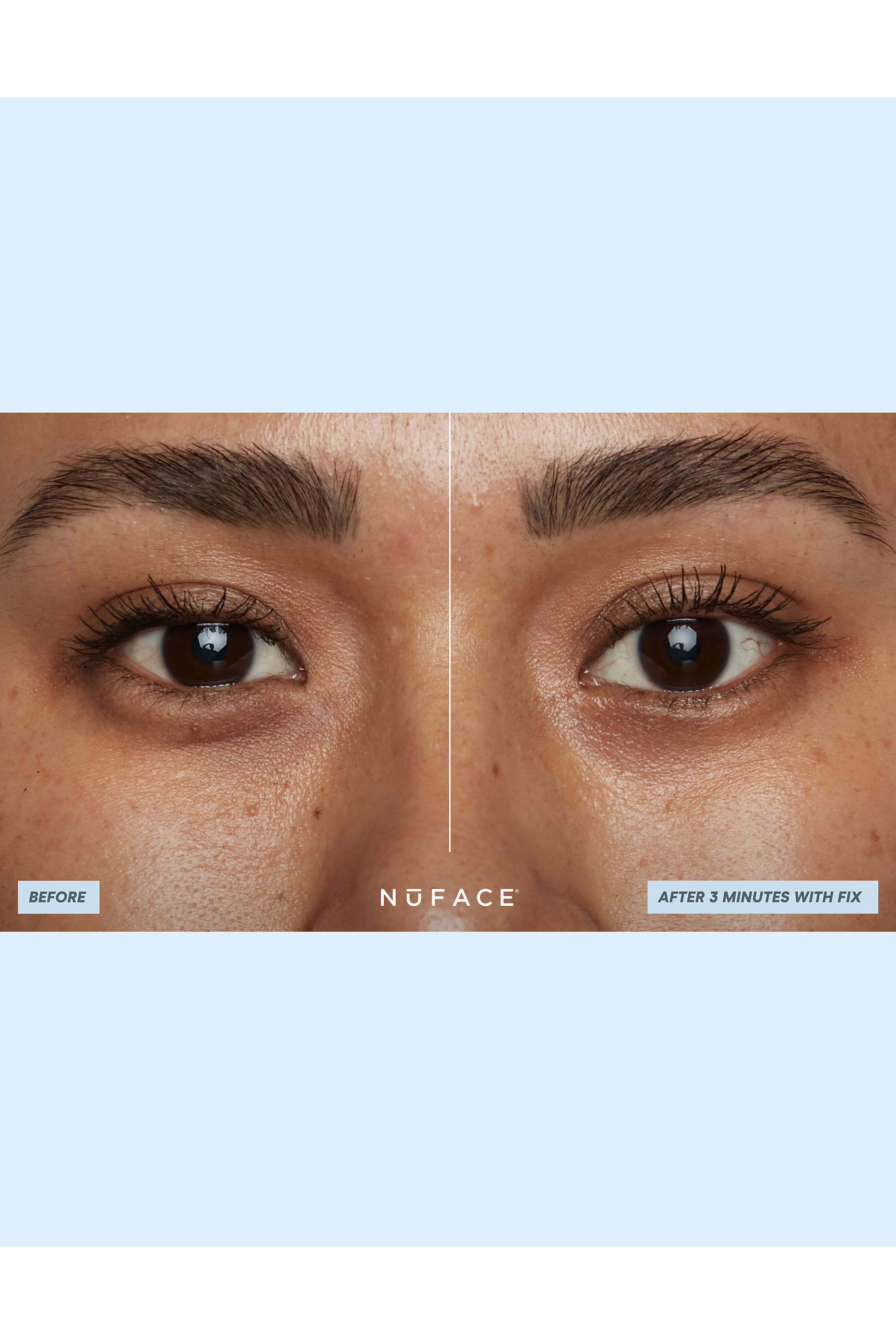 IonPlex Hydra-Gel Power Patches