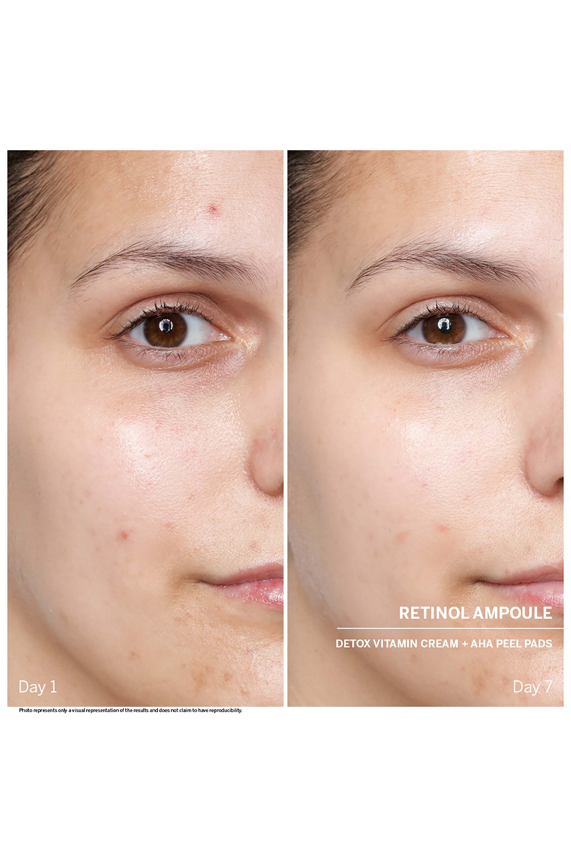 Retinol Power Serum Ampoules, Set Of 7